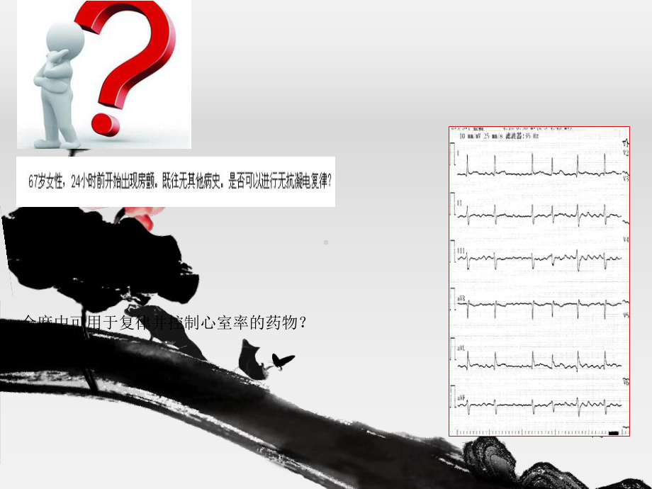 房颤病人的麻醉管理课件.ppt_第2页