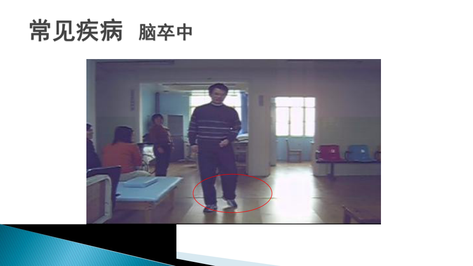 常见中枢性足下垂足内翻的处理策略课件.ppt_第3页