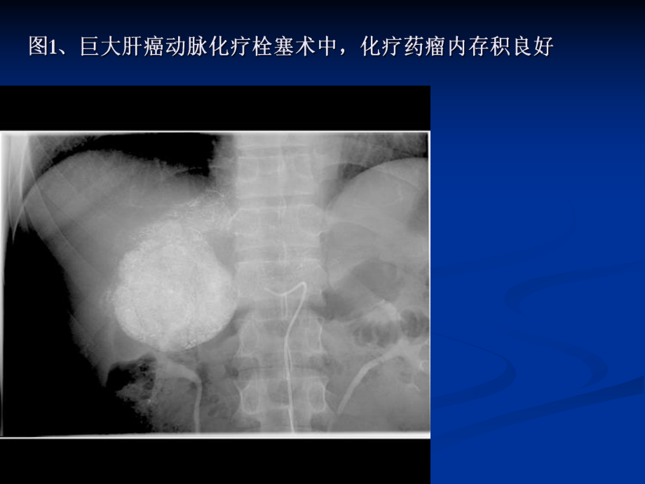 介入诊疗范围课件.ppt_第2页