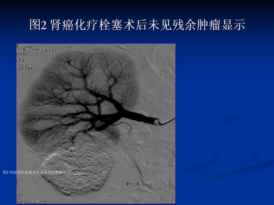 介入诊疗范围课件.ppt_第3页