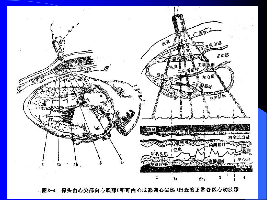 心脏超声解剖及切面课件.ppt_第3页