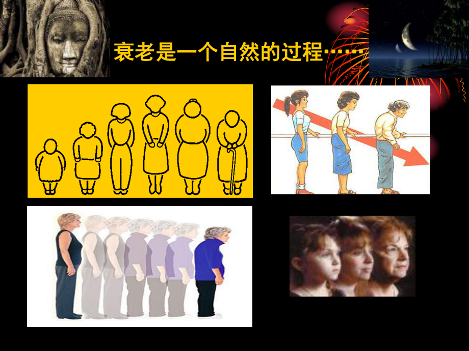 围绝经期的管理课件.ppt_第2页