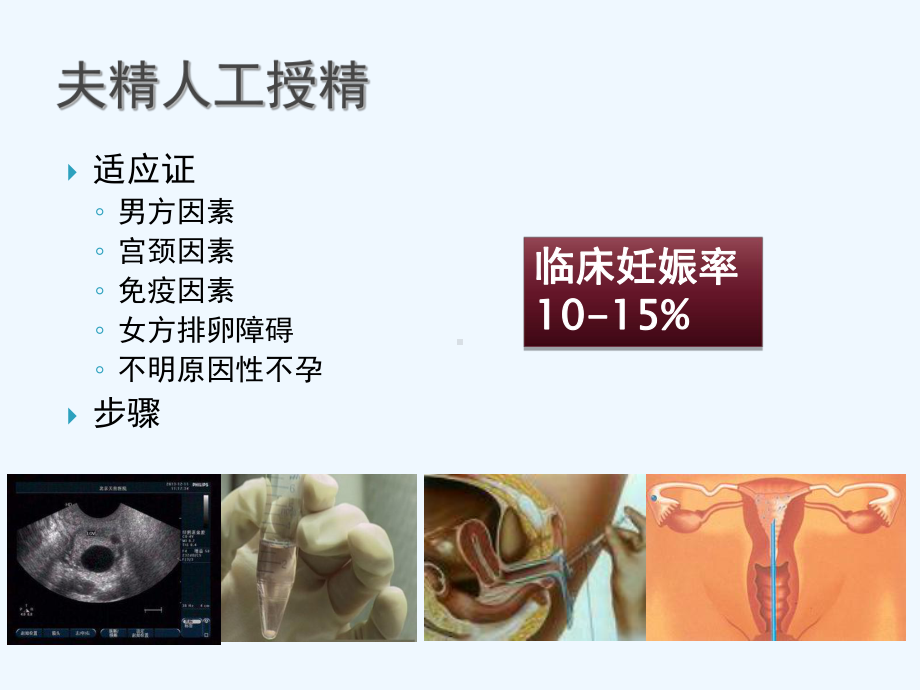 人类辅助生殖技术应用概述课件.ppt_第3页