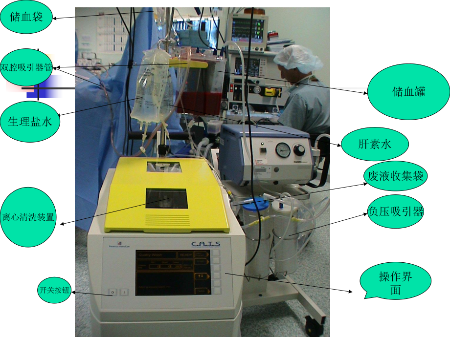 费森尤斯自体血回收机的使用及注意事项课件.ppt_第2页