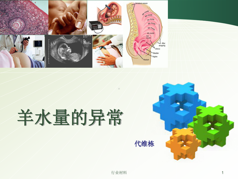 羊水异常：羊水的形成和交换、过多、过少、案例等[课件.ppt_第1页