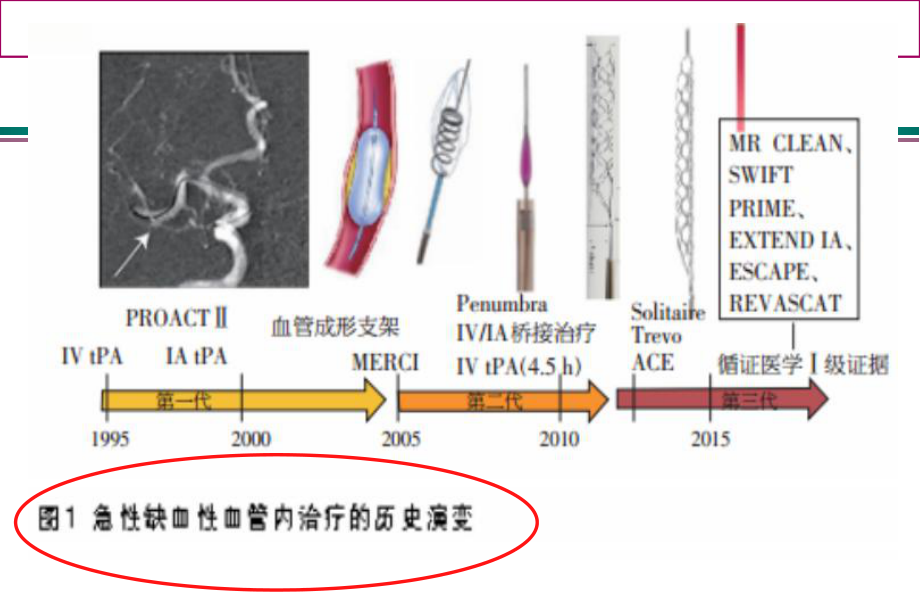 脑侧支循环评估课件.ppt_第2页