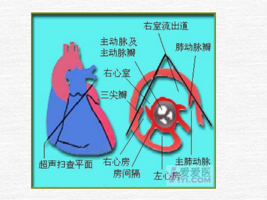 最新M型超声心动图测量及正常值课件.ppt_第3页