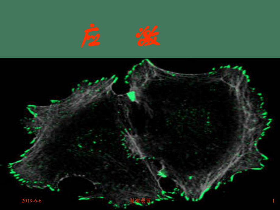 应激应激反应的基本表现解读课件.pptx_第1页