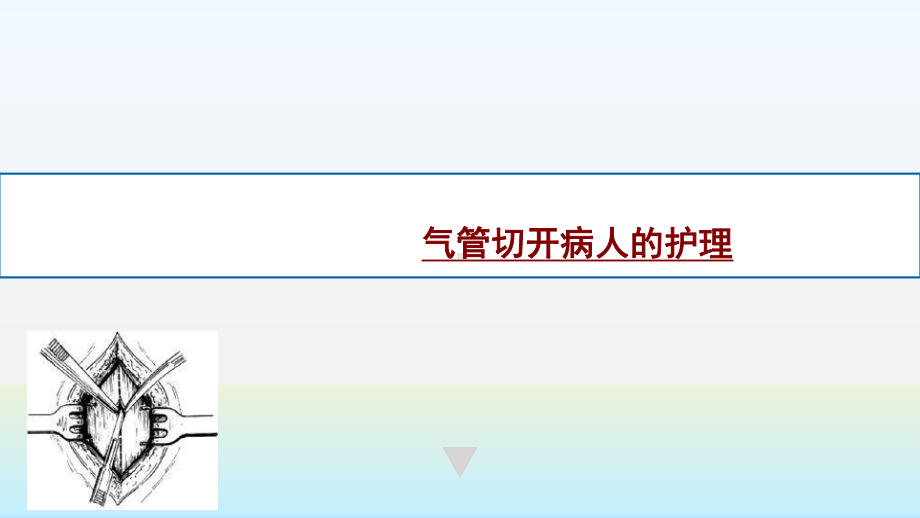 气管切开病人的护理课件.pptx_第1页