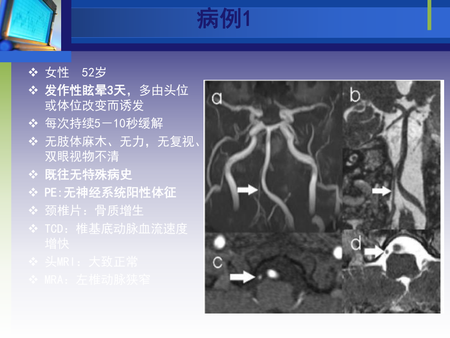 头晕诊断思路-共46页课件.ppt_第2页