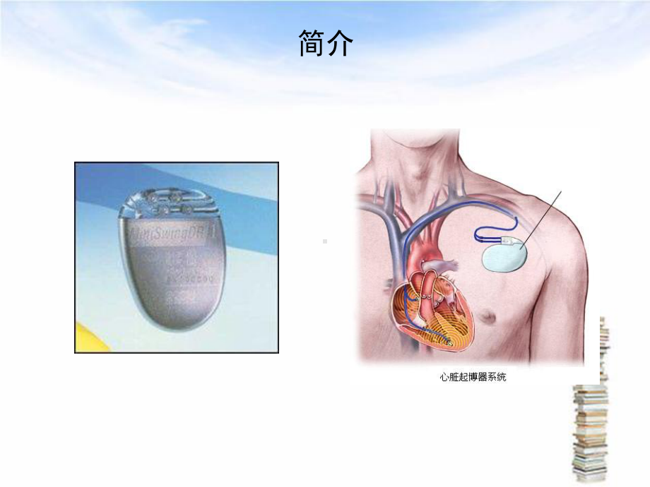 人工心脏起搏器的护理课件.ppt_第3页