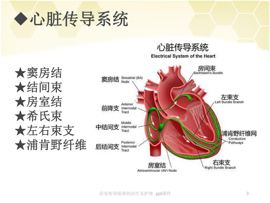 房室传导阻滞的治疗及护理-ppt课件(同名17).ppt_第3页