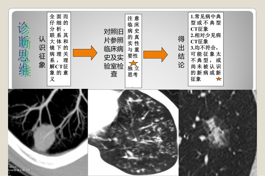 肺部病变的常见的CT征象诊断课件.ppt_第3页