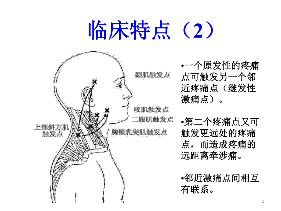 头痛激痛点PPT课件.ppt_第2页