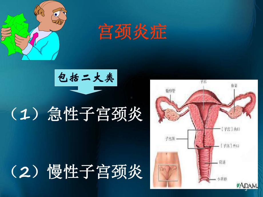 宫颈炎正式PPT幻灯片课件.ppt_第3页