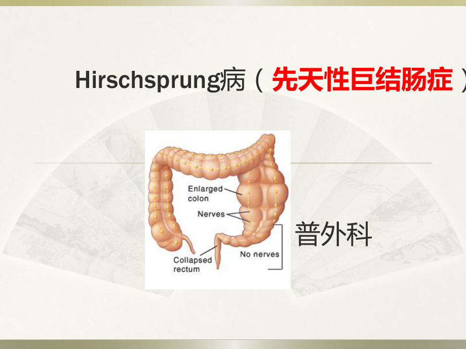 先天性巨结肠症查房(Hirschsprung病)课件.pptx_第1页