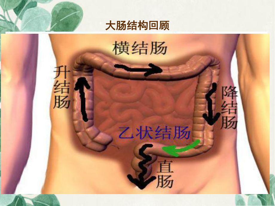 肠癌患者的护理.ppt课件.ppt_第3页