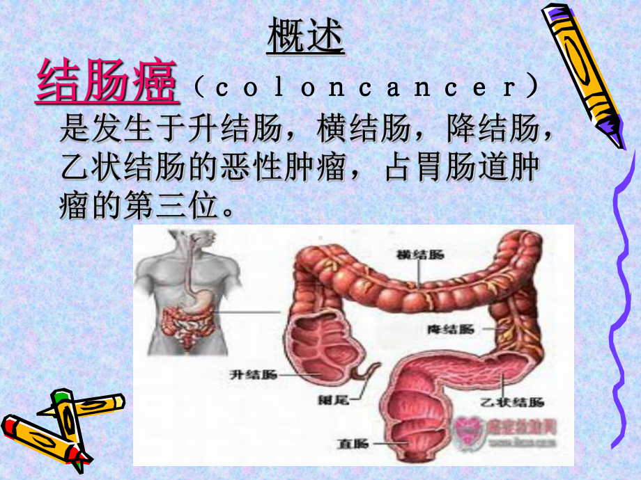 右半结肠切除术患者护理查房ppt课件.ppt_第3页