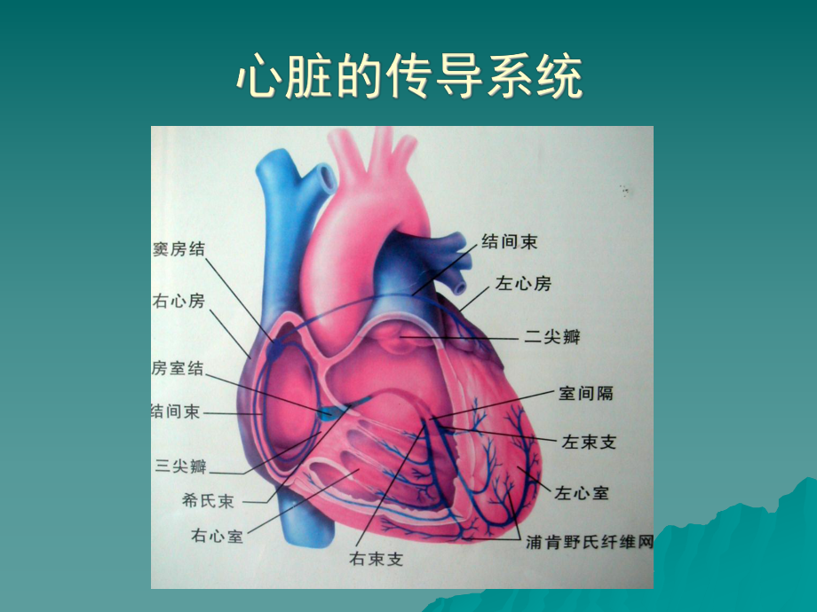 常见心律失常-ppt课件.ppt_第3页