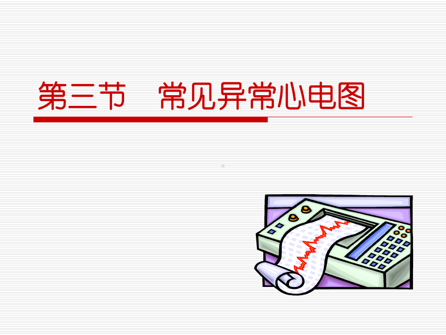 常见异常心电图资料讲解课件.ppt_第2页