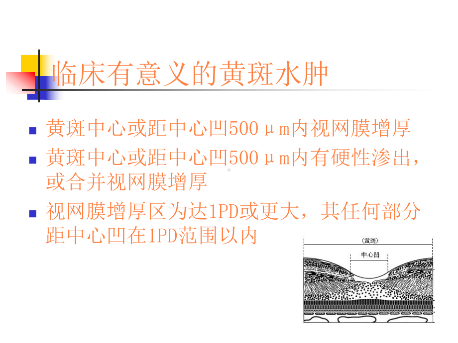 糖尿病性黄斑水肿PPT课件.ppt_第3页