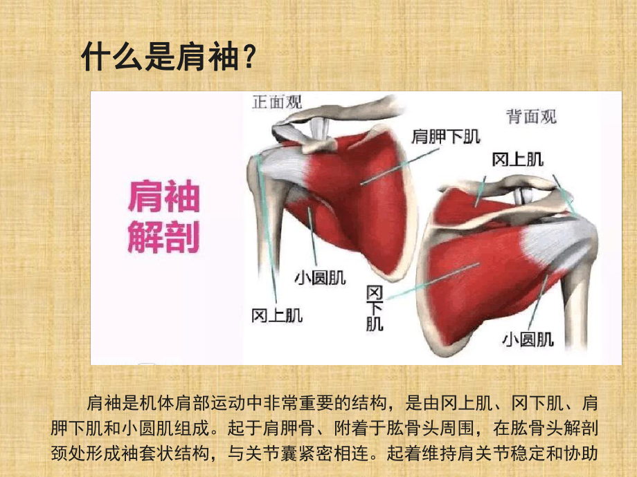 肩袖损伤护理疾病查房课件.ppt_第3页