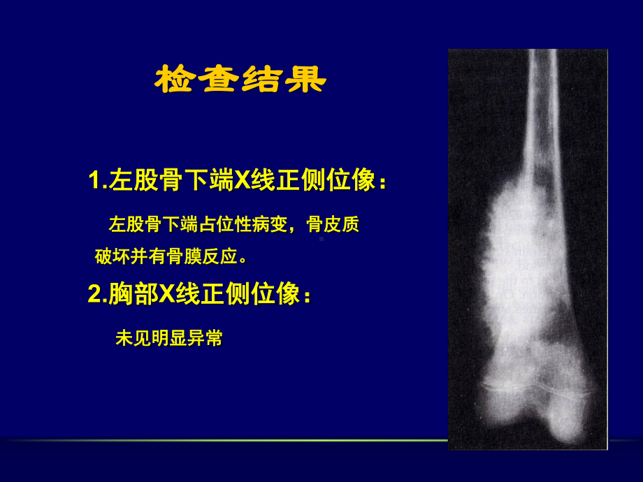 肿瘤形态解析共59页文档课件.ppt_第3页