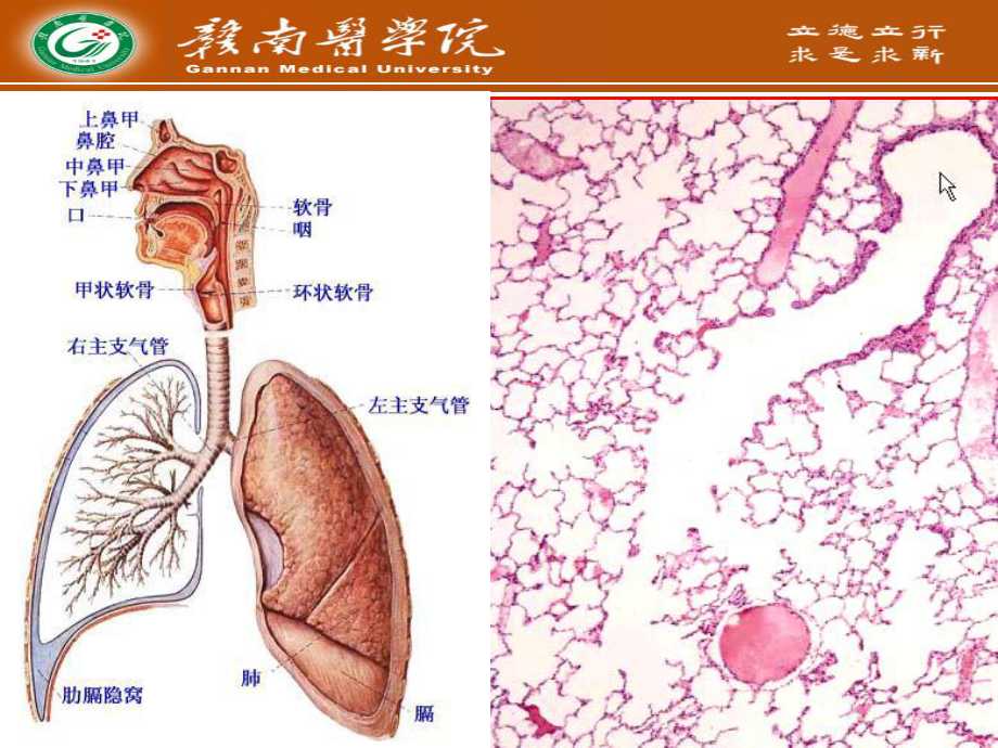 大叶性肺炎-ppt课件.ppt_第3页