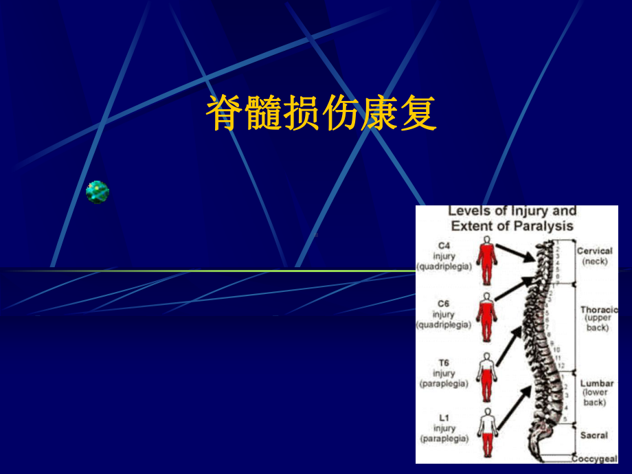 脊髓损伤康复.ppt课件.ppt_第1页