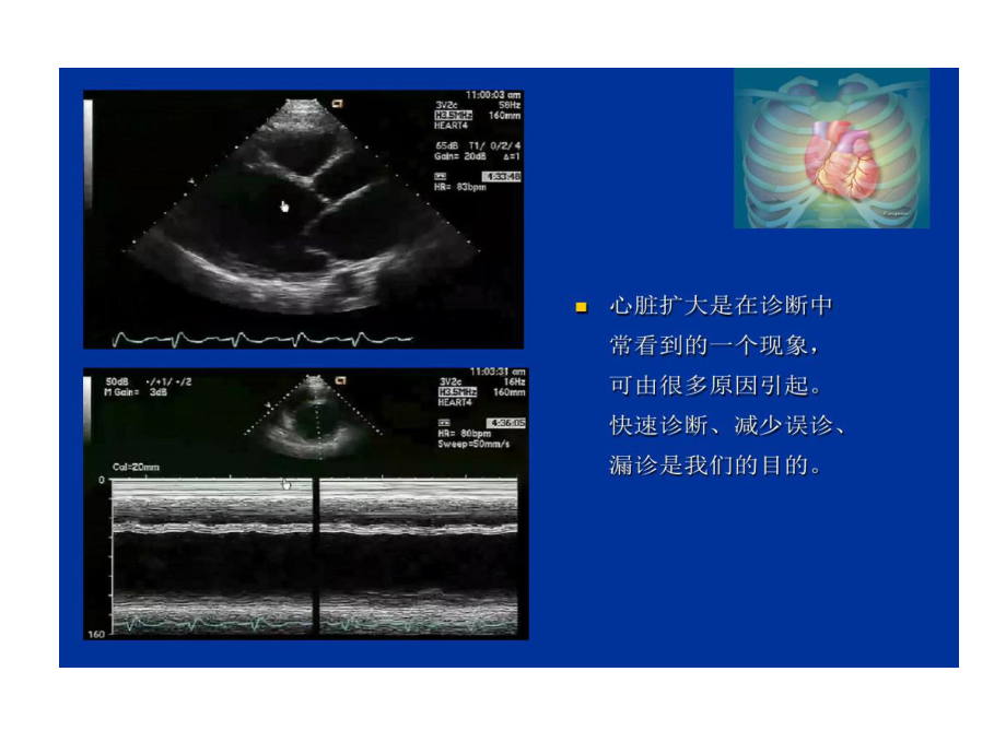 心脏扩大超声诊断思路共53页课件.ppt_第2页