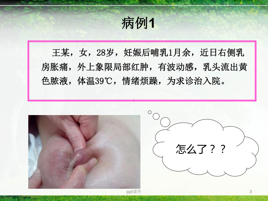 急性乳腺炎-ppt课件.ppt_第3页