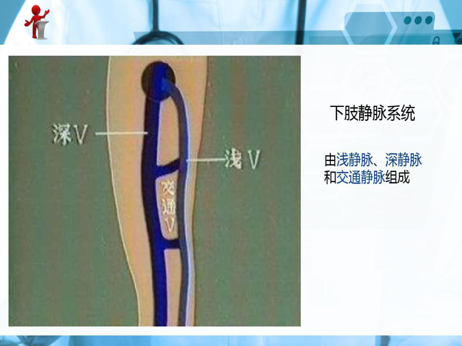 外科护理-原发性下肢静脉曲张病人的护理共37页文档课件.ppt_第2页