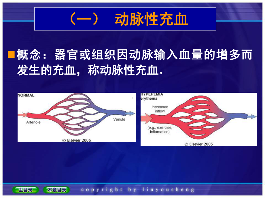 3.局部血液循环障碍（基础医学概论28H-刘利兵版）课件.ppt_第3页