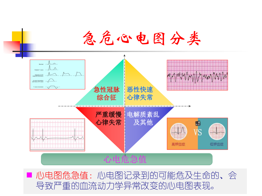 急危心电图识别与处理课件.ppt_第2页