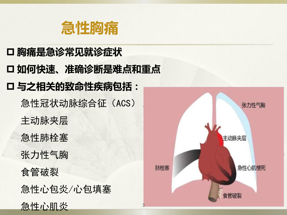 高危胸痛诊断思路PPT课件.ppt_第3页