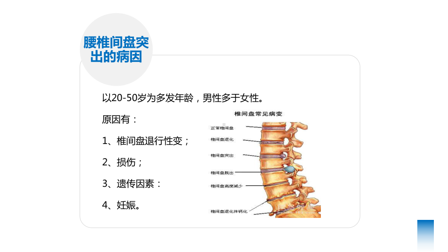 2022腰椎间盘突出的健康教育PPT模板.pptx_第2页