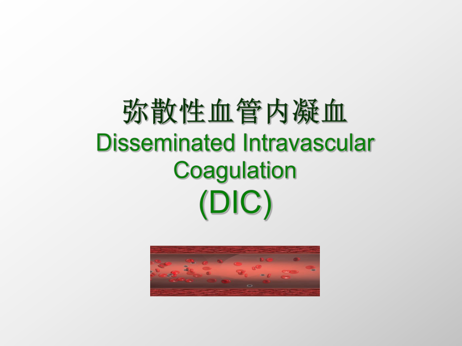 弥散性血管内凝血25课件.ppt_第1页