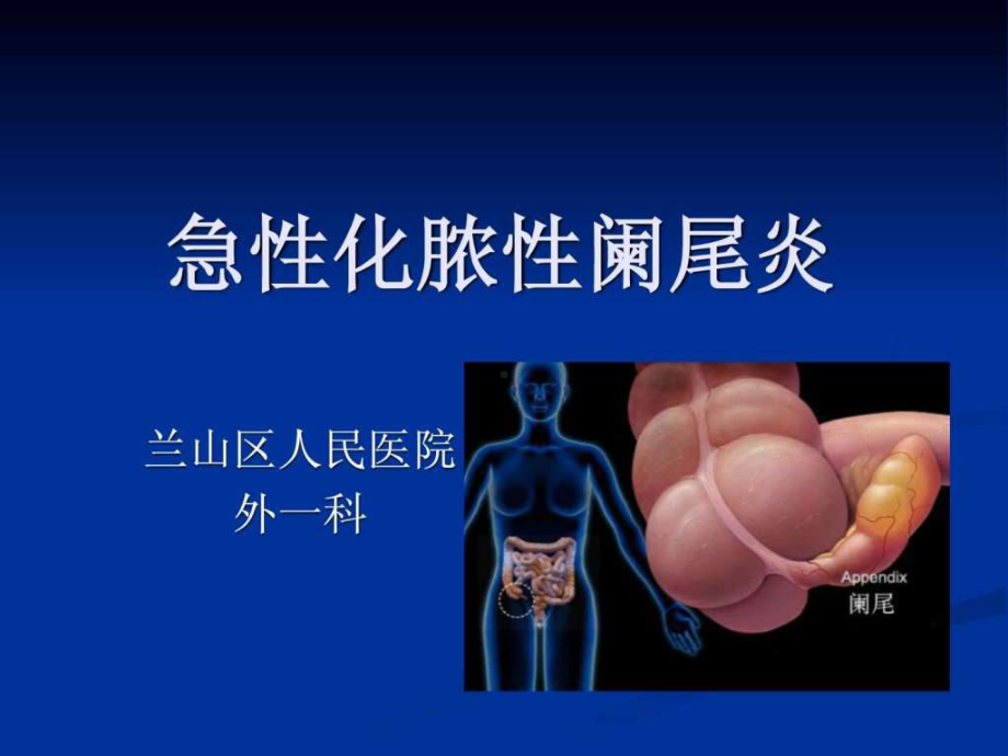 急性化脓性阑尾炎PPT课件.ppt_第1页