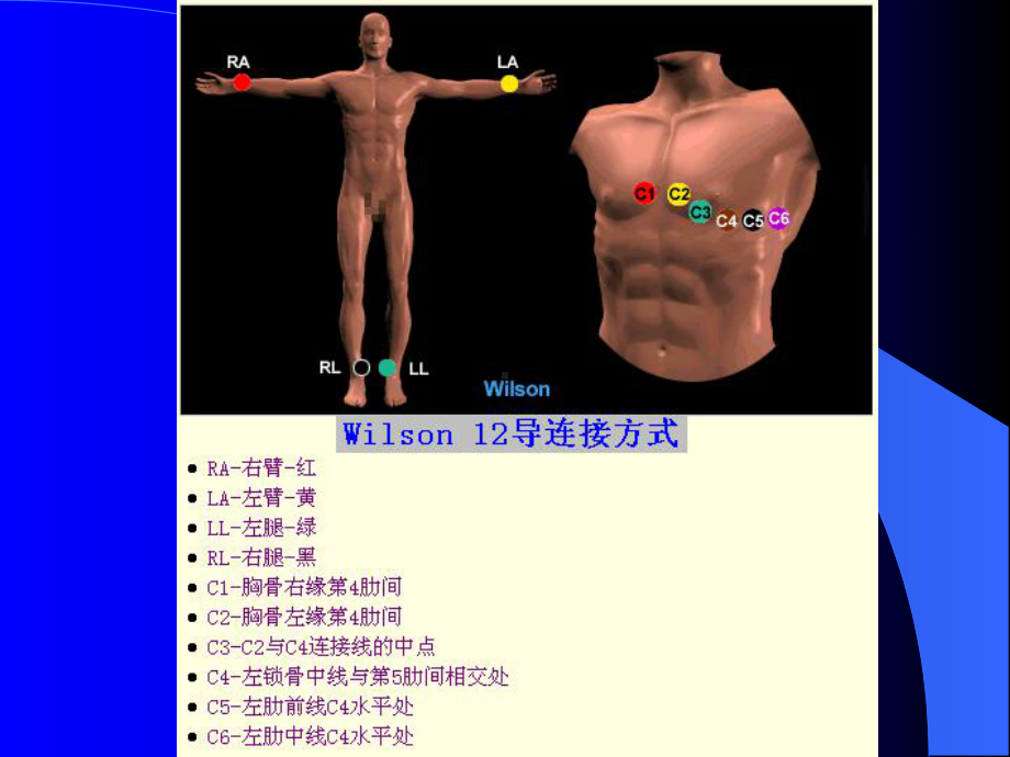 心电图幻灯(实习讲课)课件.ppt_第2页