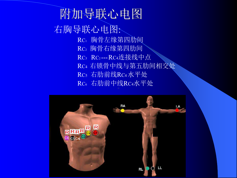 心电图幻灯(实习讲课)课件.ppt_第3页