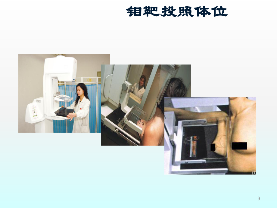 乳腺影像诊断ppt课件.ppt_第3页