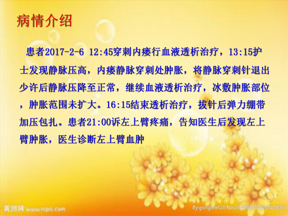 动静脉内瘘血肿护理查房课件.ppt_第3页