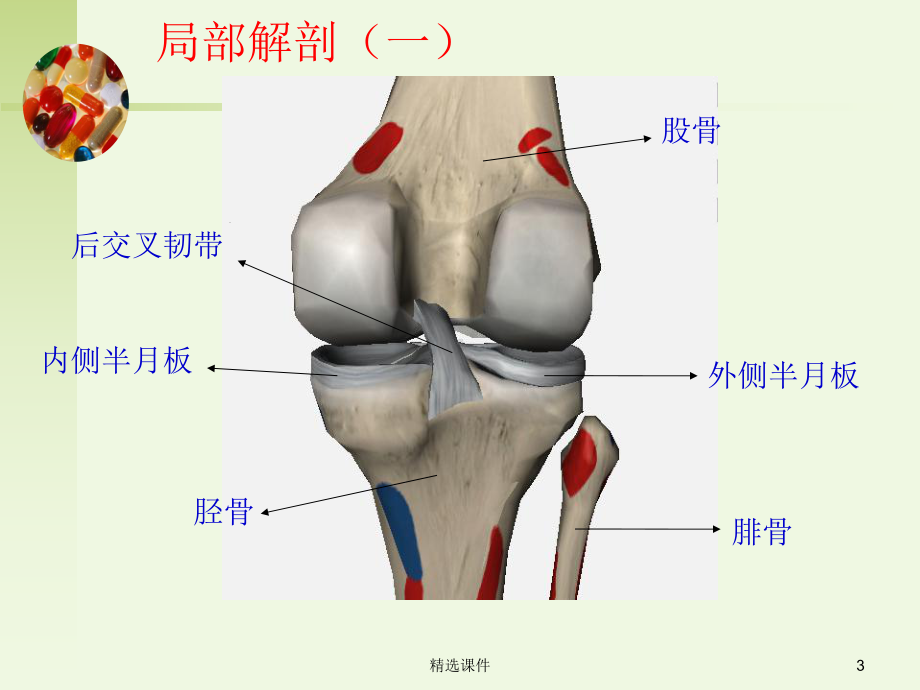 后交叉韧带损伤的诊疗课件.ppt_第3页