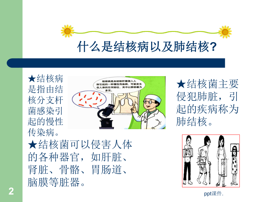 学生结核病防治知识宣传ppt课件.ppt_第2页