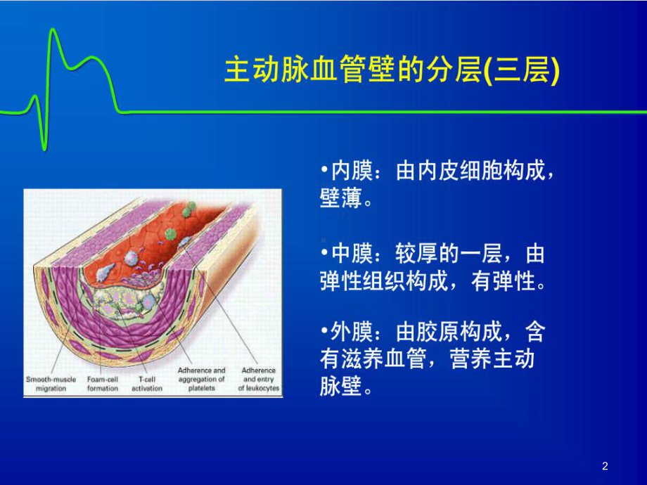 主动脉夹层PPT课件.ppt_第2页