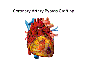 冠状动脉搭桥术CABGPPT课件.ppt