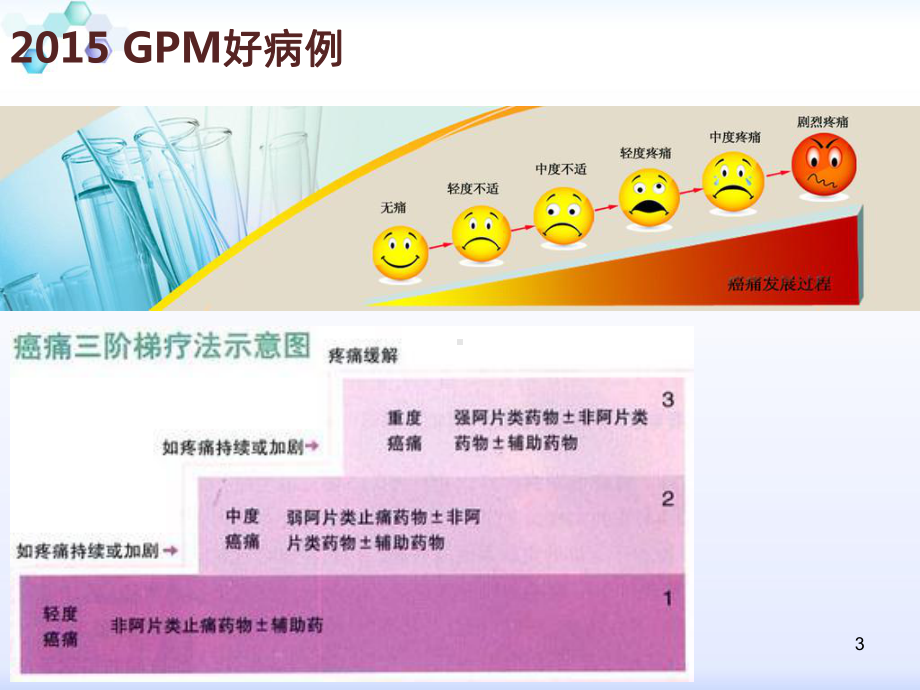 癌痛规范化治疗PPT1课件.ppt_第3页