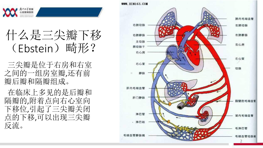 三尖瓣下移畸形的护理查房PPT课件.ppt_第2页