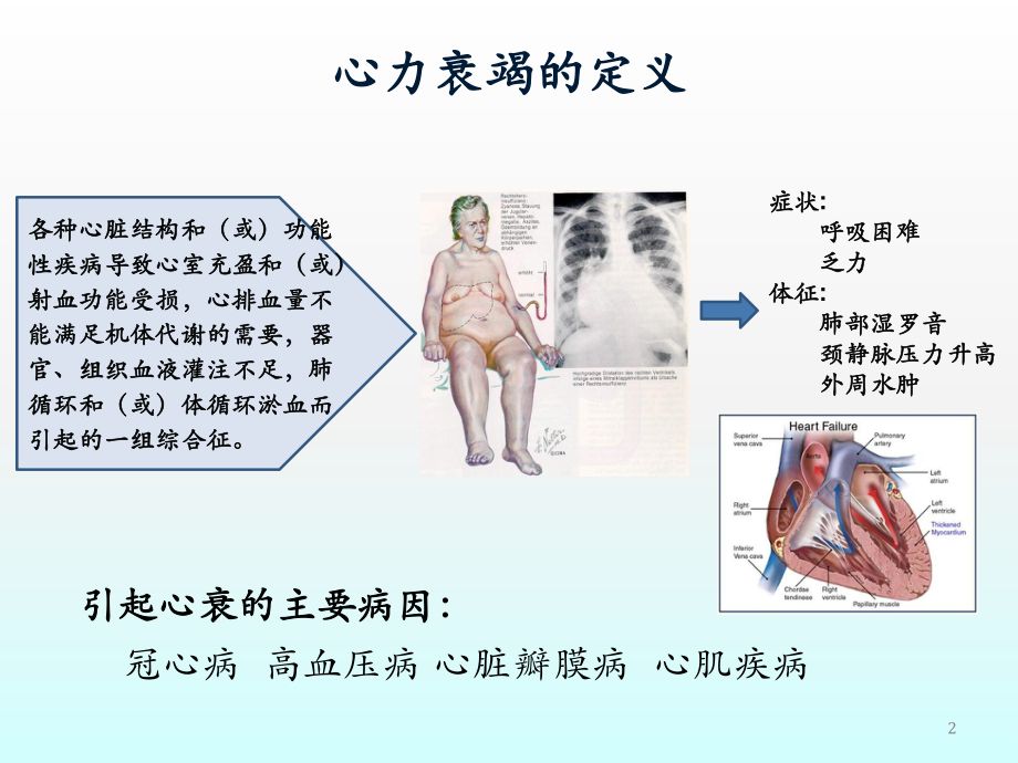 心力衰竭PPT课件.pptx_第2页