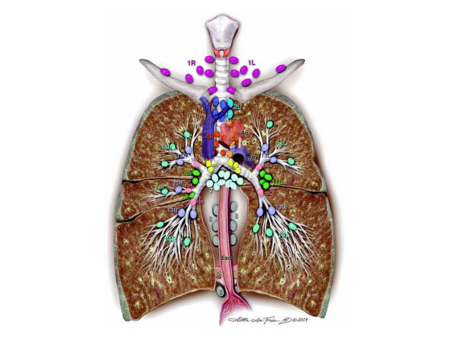 纵隔淋巴结IASLC课件.ppt_第2页